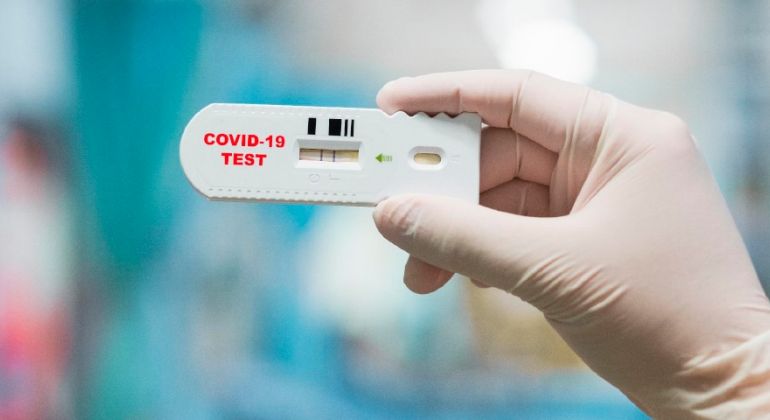 Adufg-Sindicato firma convênio com laboratórios para exames de detecção do novo coronavírus